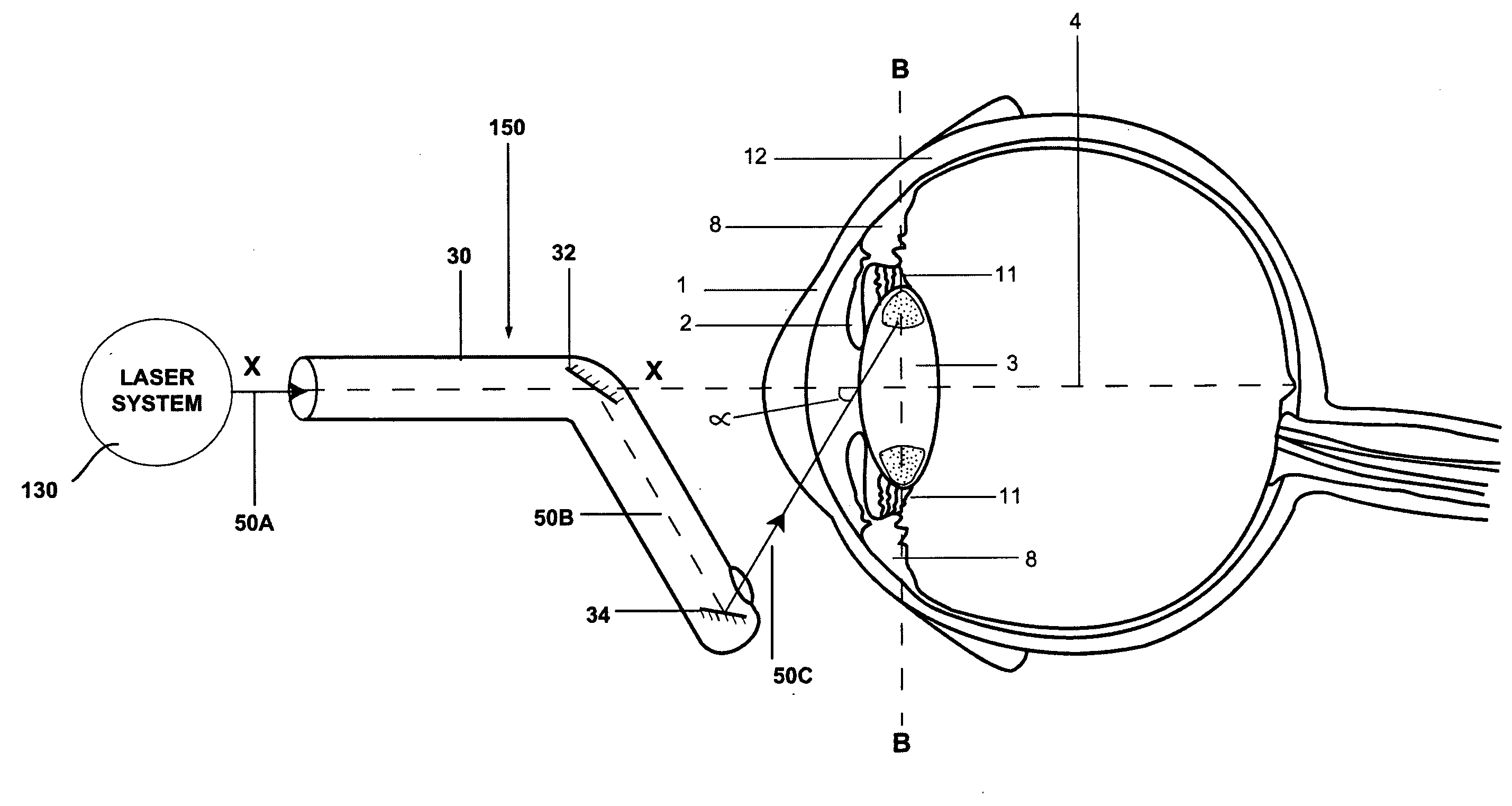 A method and a system for laser photoablation within a lens