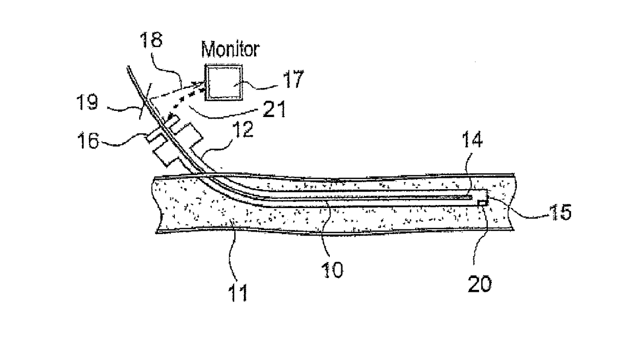 Endovascular Method and Apparatus with Electrical Feedback
