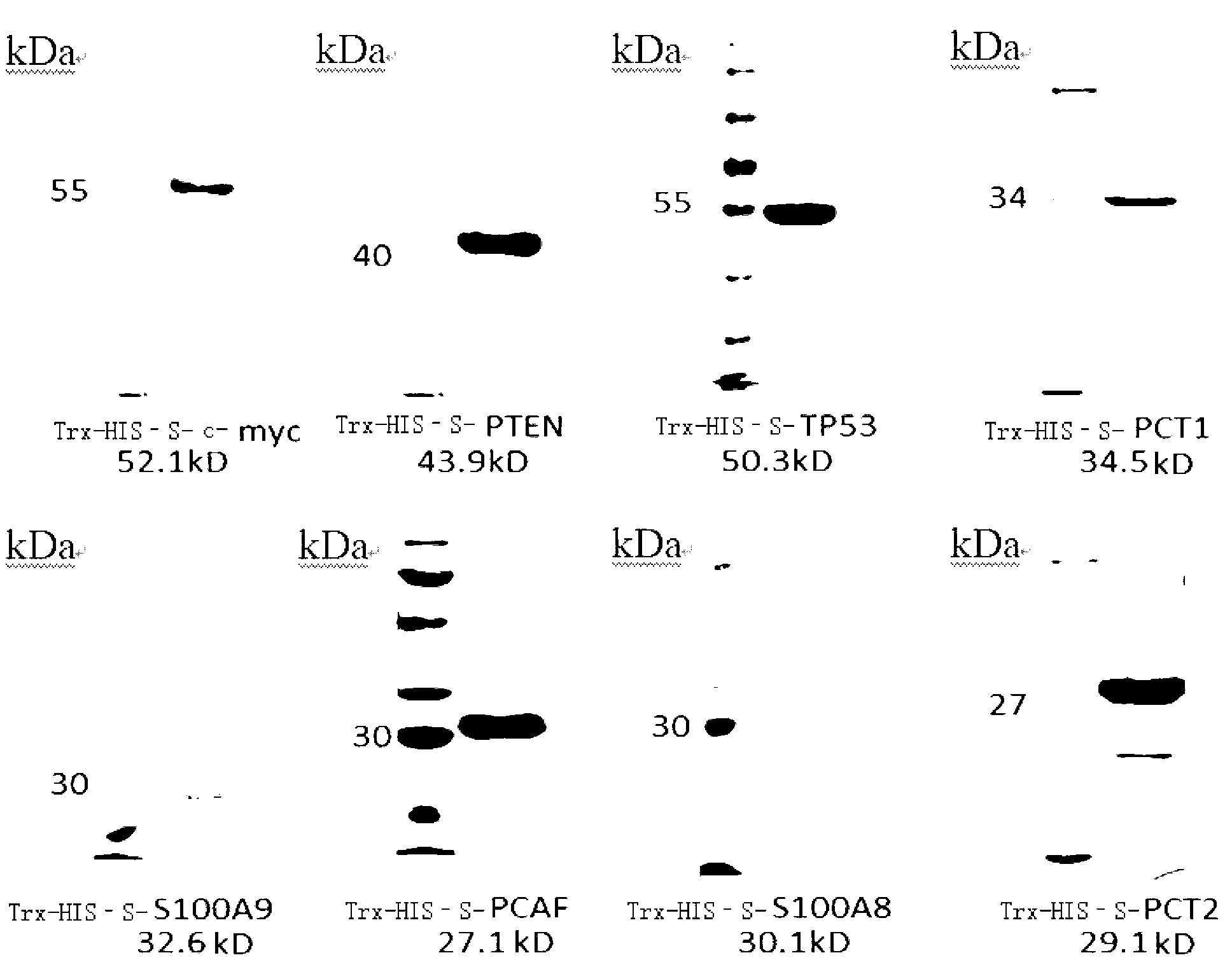 Methods for preparing monoclonal antibody and hybridoma cell strain thereof by multiple antigens in immune high-flux manner