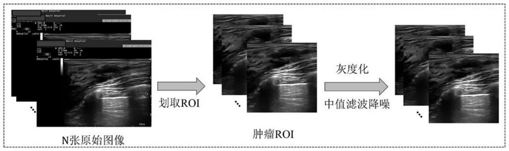 Early prediction method for curative effect of cancer chemotherapy based on two-channel convolutional neural network