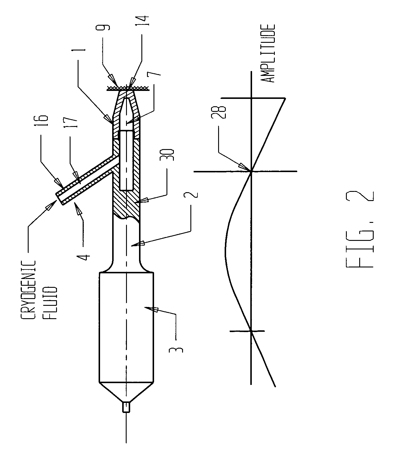 Apparatus and methods for the selective removal of tissue using combinations of ultrasonic energy and cryogenic energy