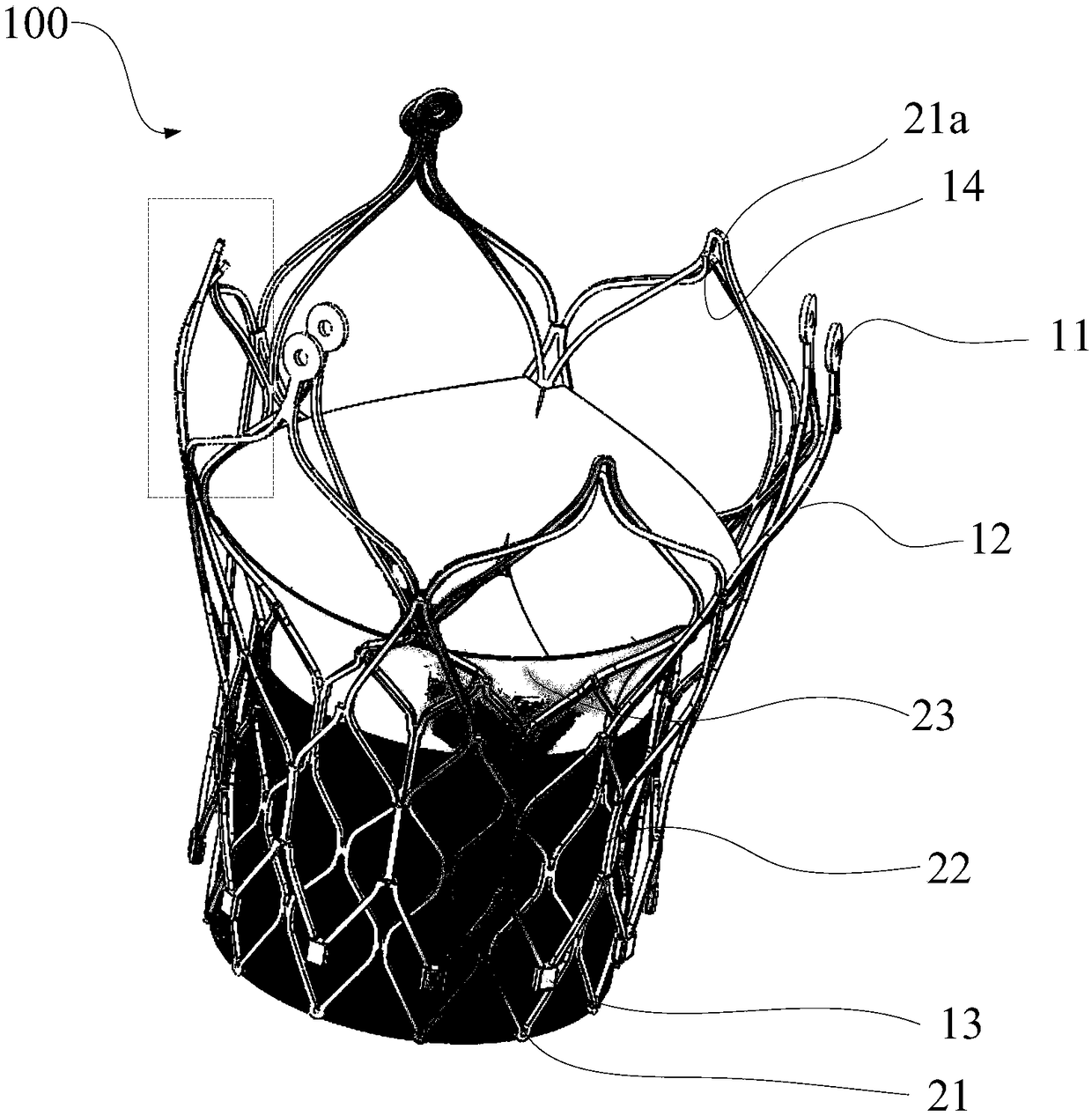 Interventional valve assembly, interventional valve fixing device and application thereof