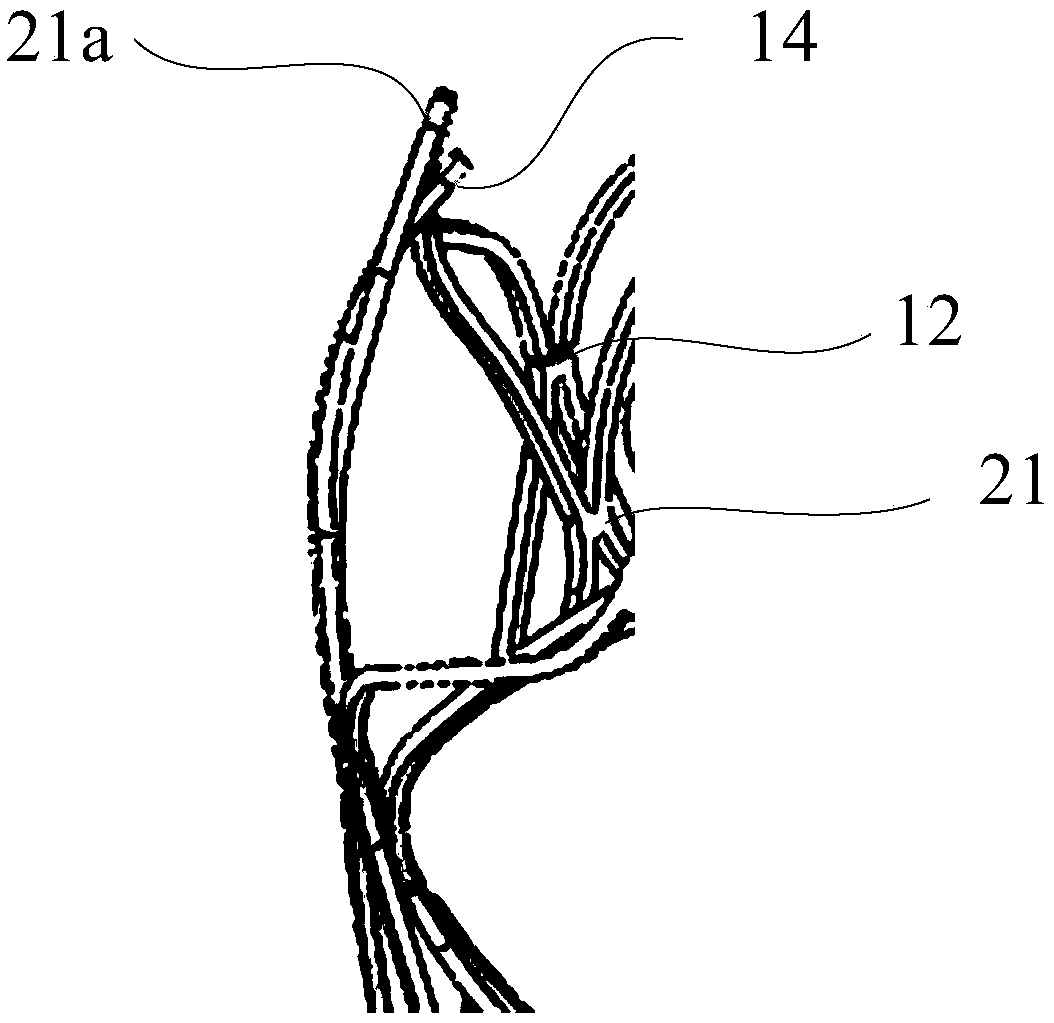 Interventional valve assembly, interventional valve fixing device and application thereof