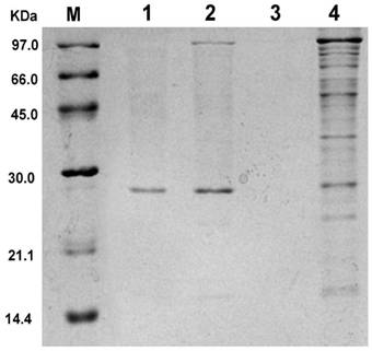 A kind of method utilizing transglutaminase and chitosan to prepare ferritin-chitosan complex