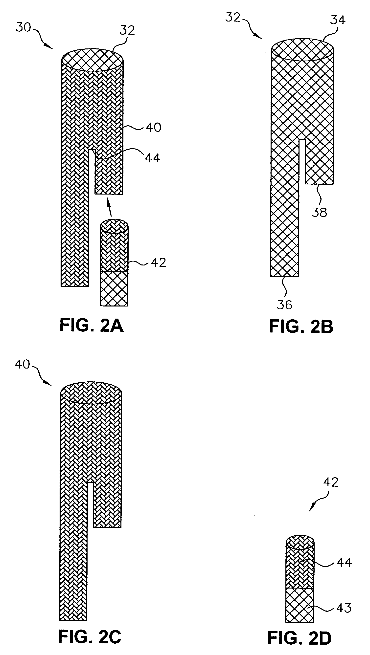 One-branch stent-graft for bifurcated lumens