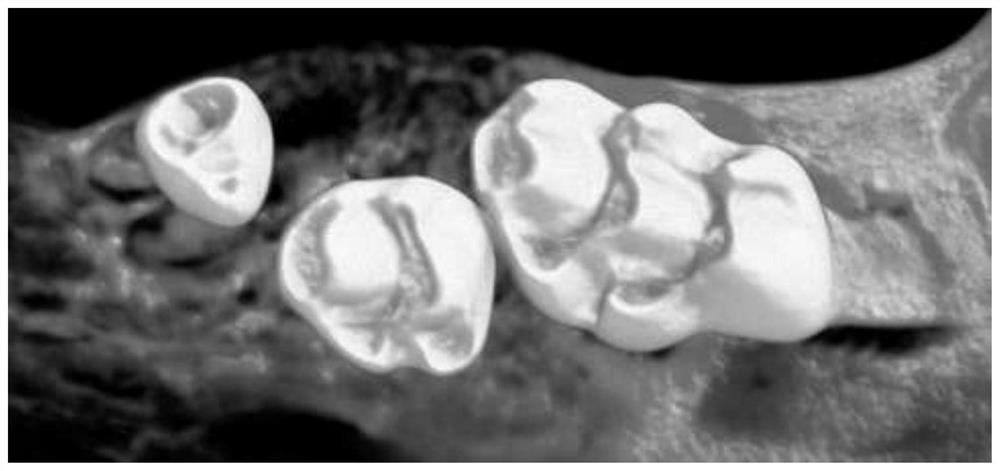 Modeling method for mouse with complex periodontitis and tooth movement