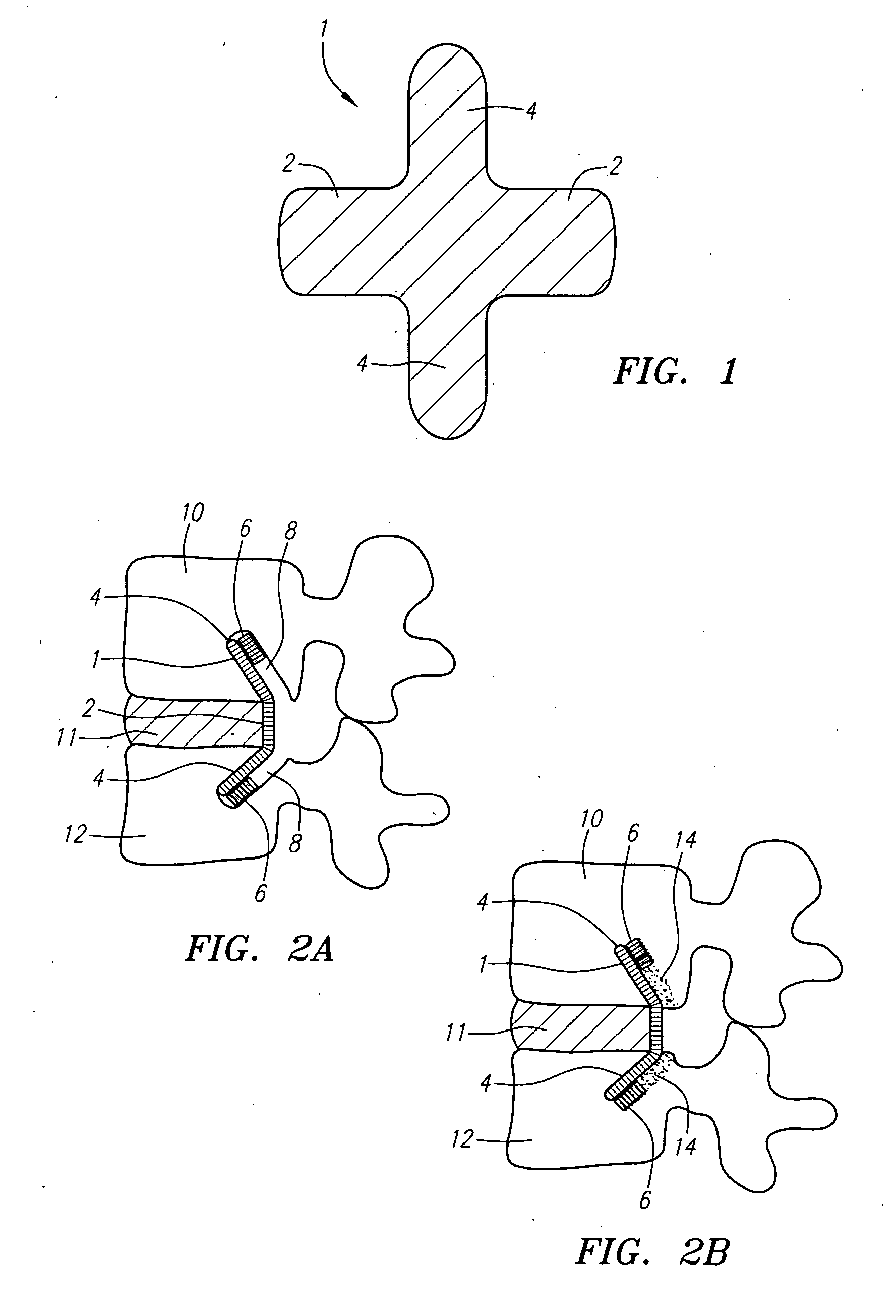 Methods and apparatus for reconstructing the anulus fibrosus