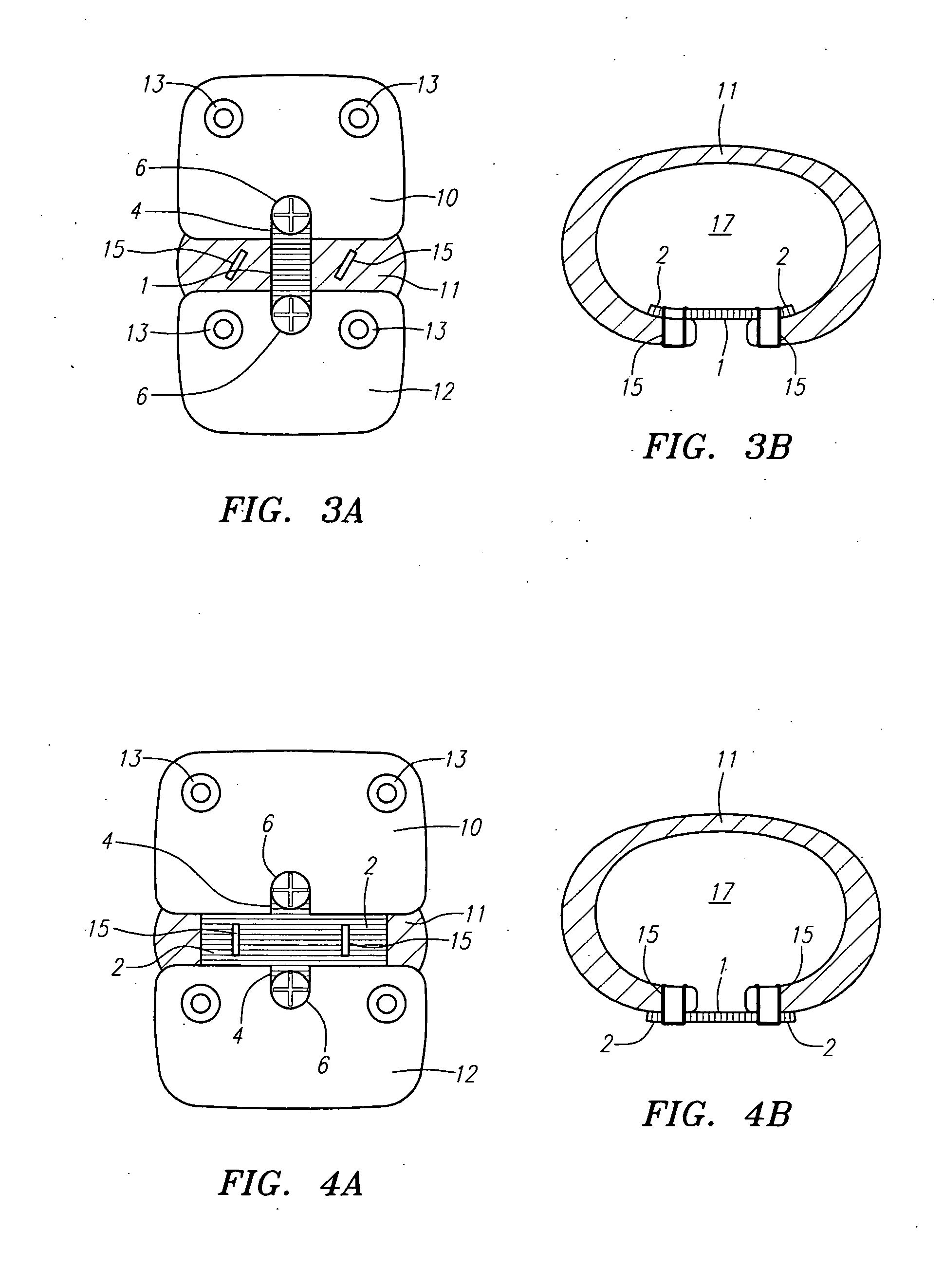 Methods and apparatus for reconstructing the anulus fibrosus
