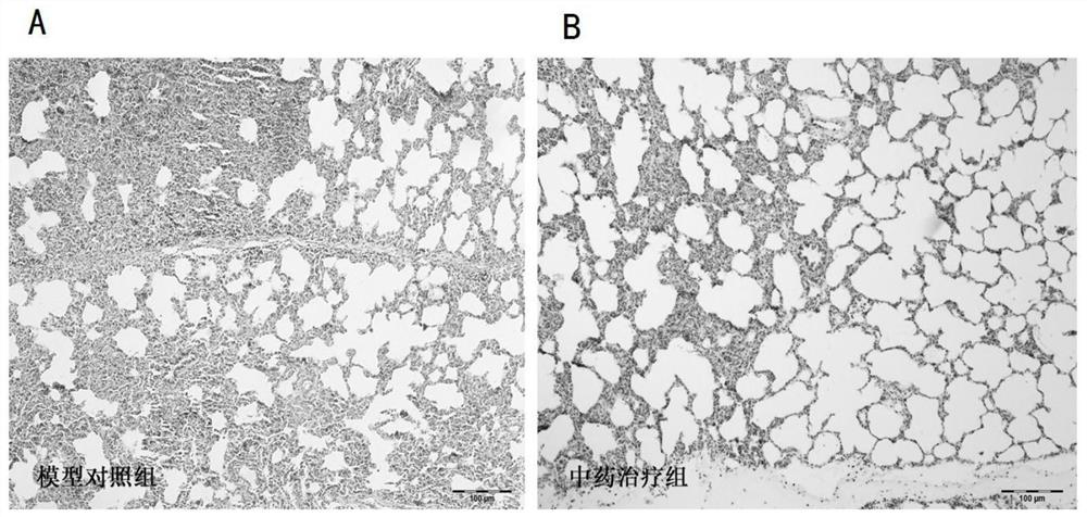 Traditional Chinese medicine prescription for treating porcine reproductive and respiratory syndrome and preparation method thereof