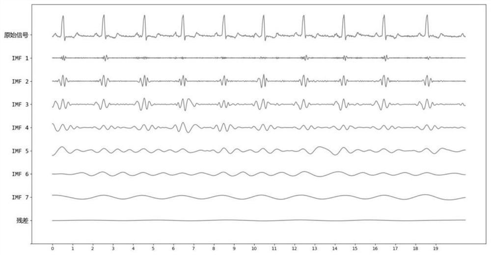 A Noise Reduction Method for ECG Signal Based on Heterogeneous Computing