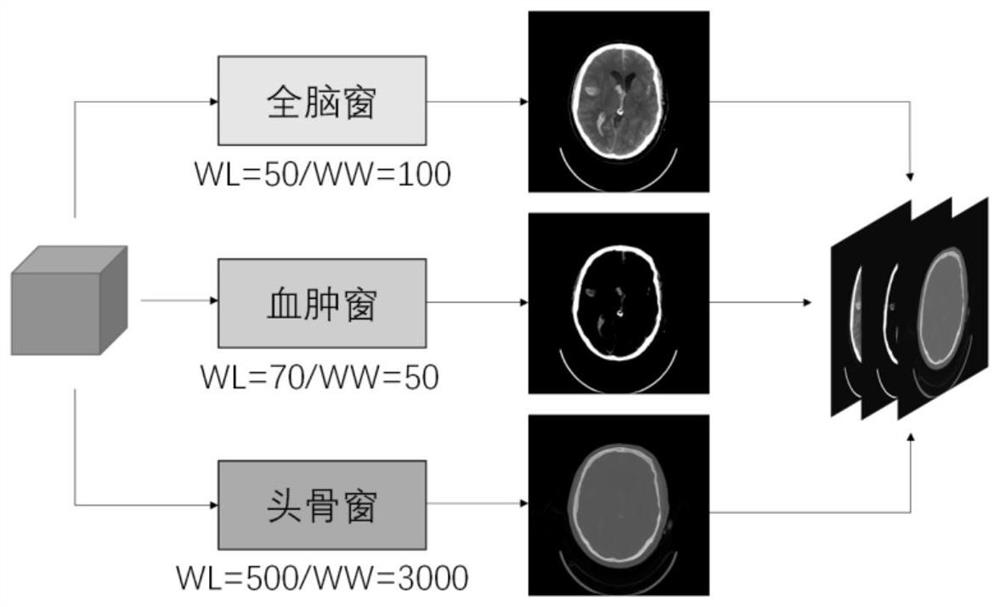 Cerebral hemorrhage CT image classification method based on image sequence analysis