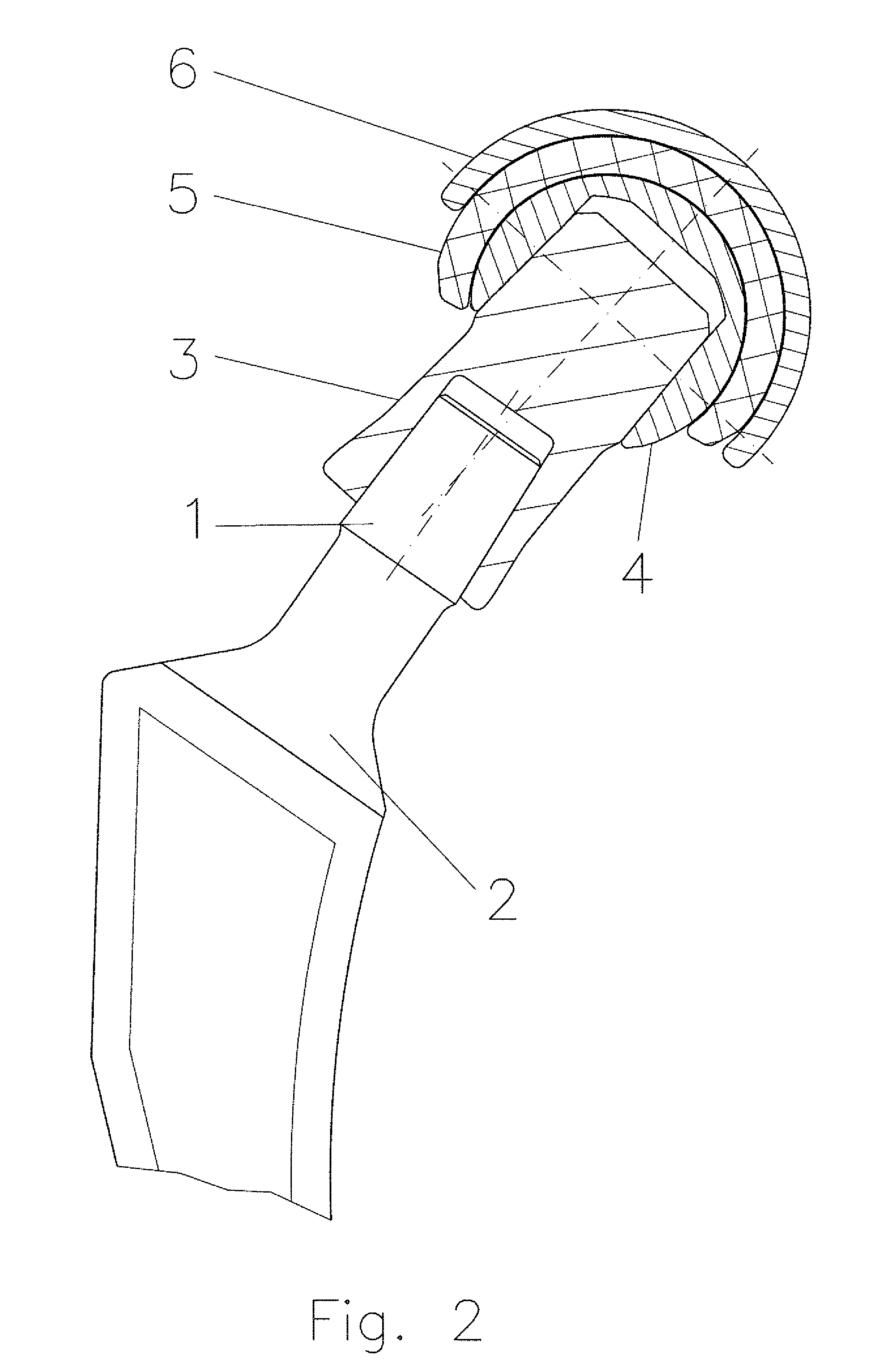 Modular Joint Prosthesis System, Premounted Joint Prosthesis System Part and Sterile Article