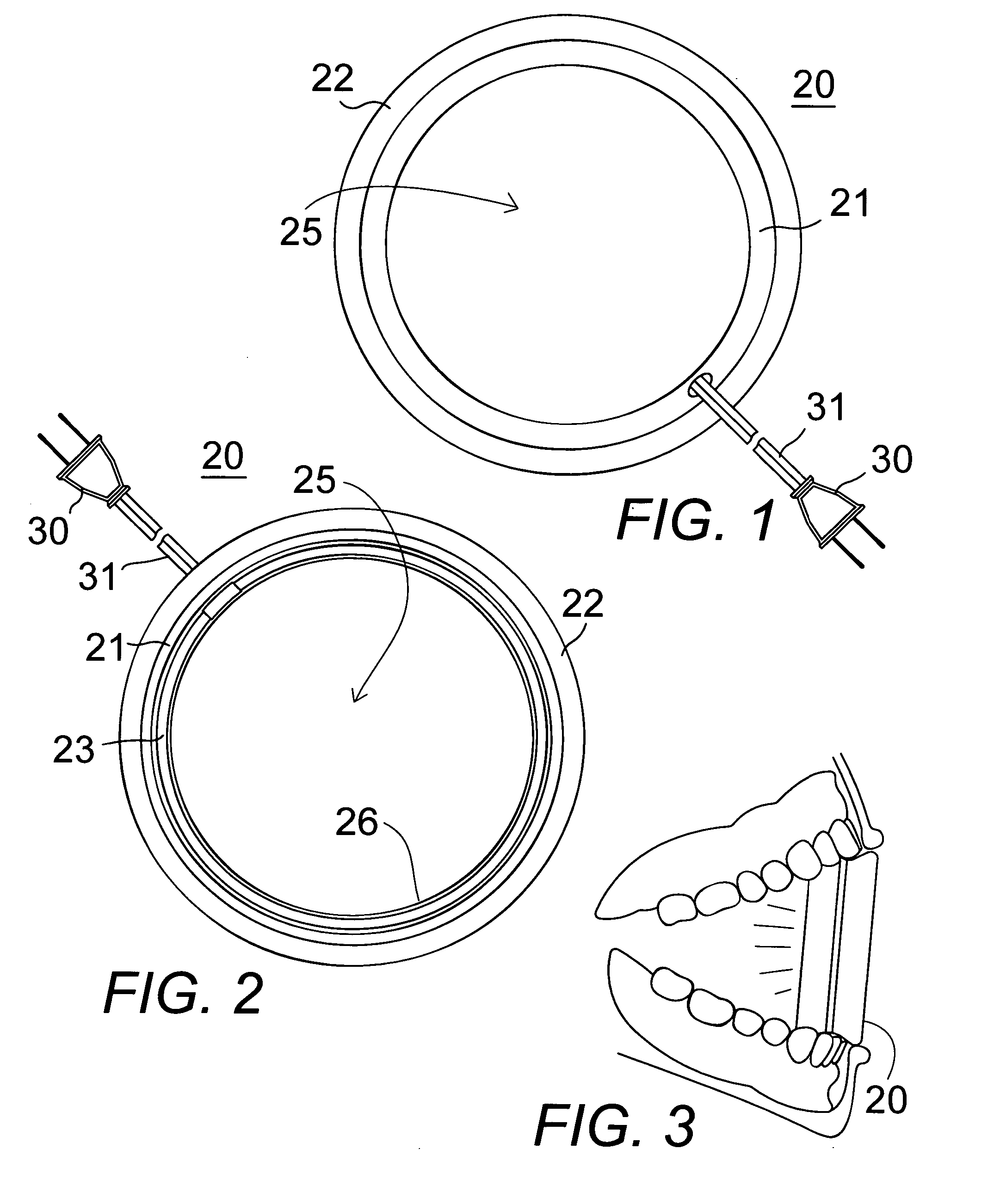 Ring-shaped illuminated mouth prop