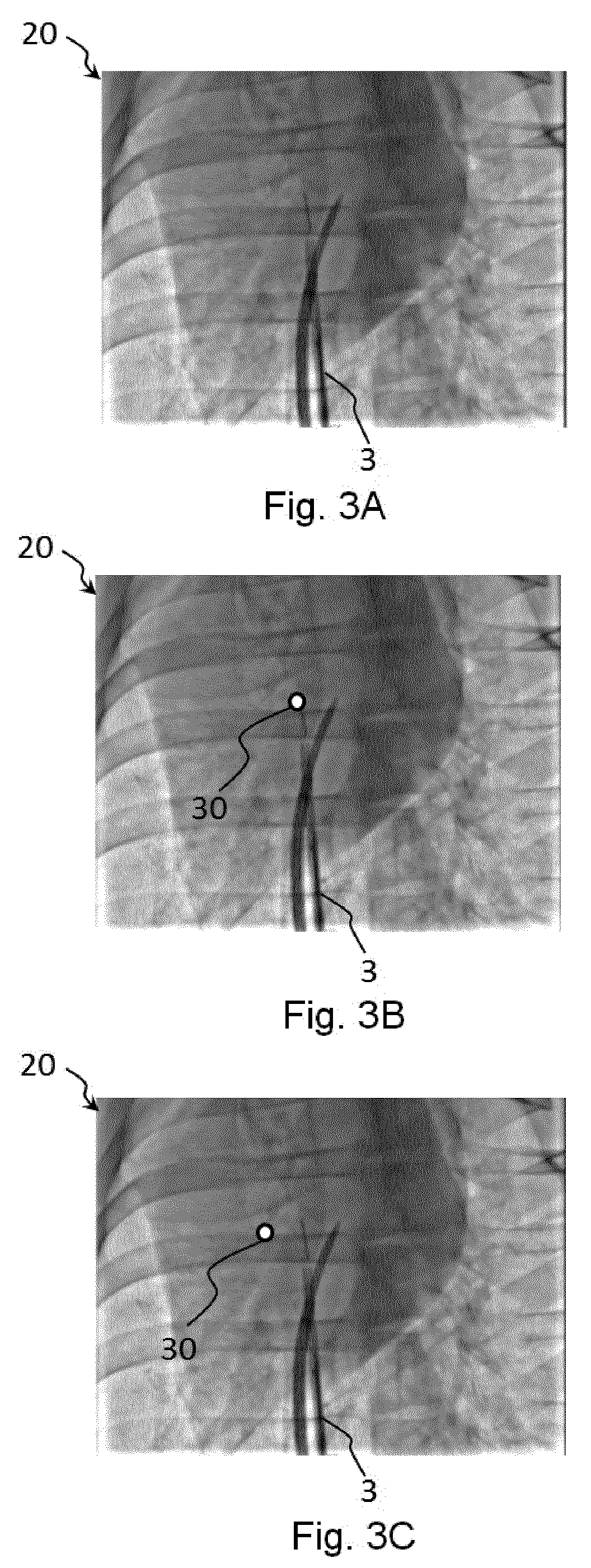 Visualization of an image object relating to an instrucment in an extracorporeal image