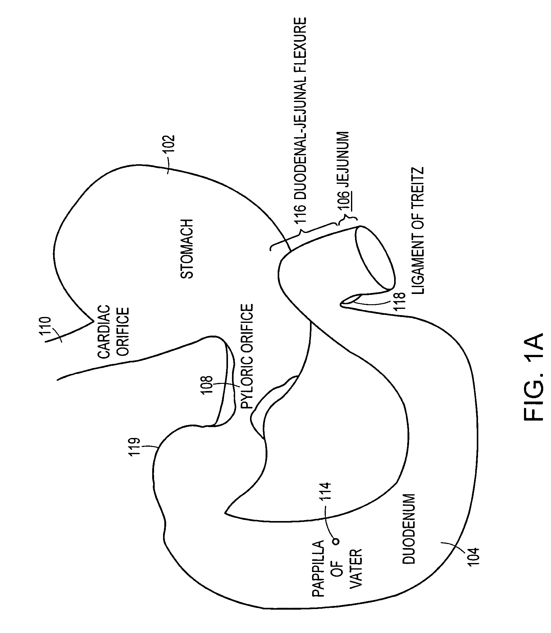 Methods and devices for placing a gastrointestinal sleeve