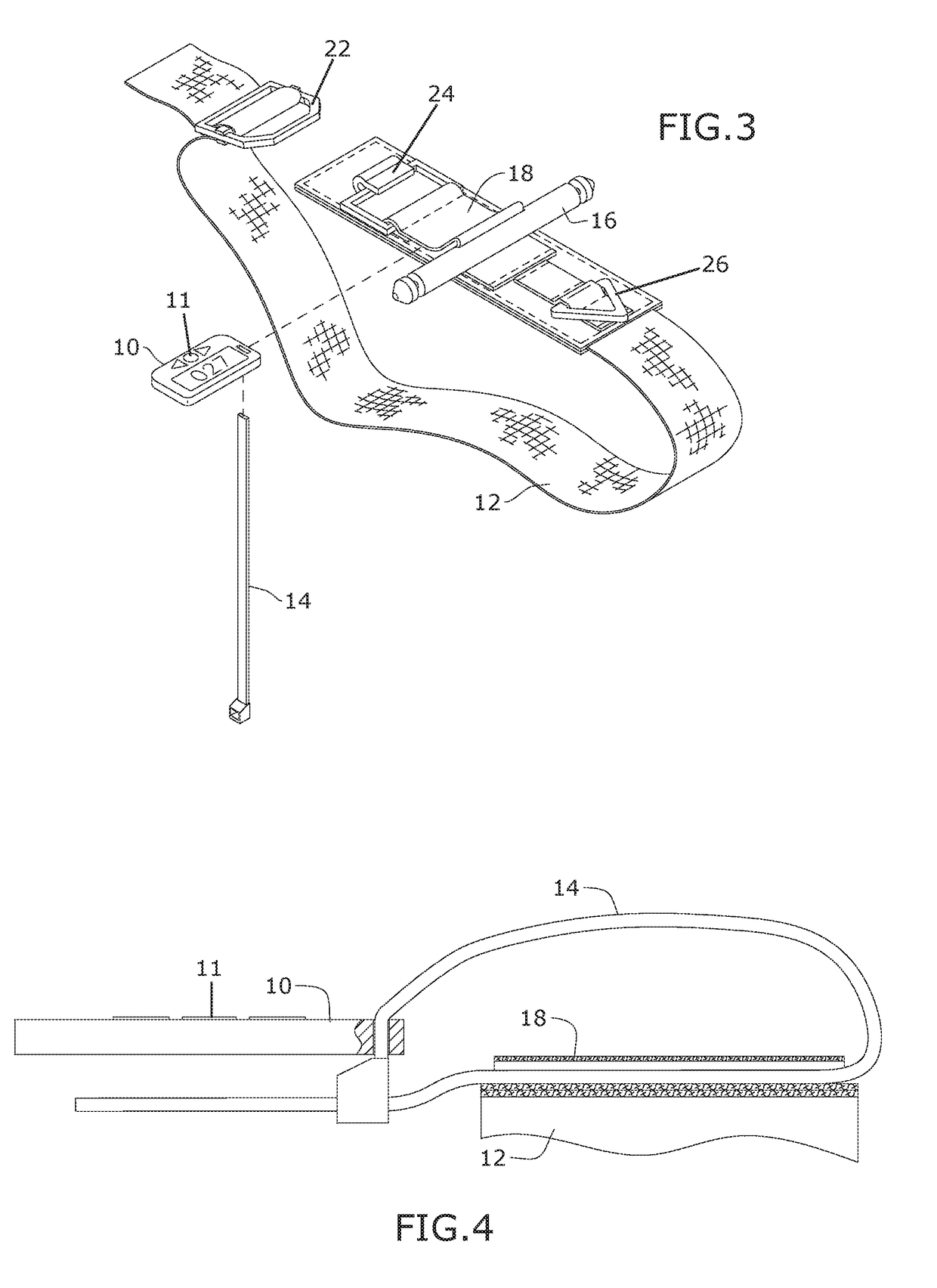 Tourniquet with an attached timer