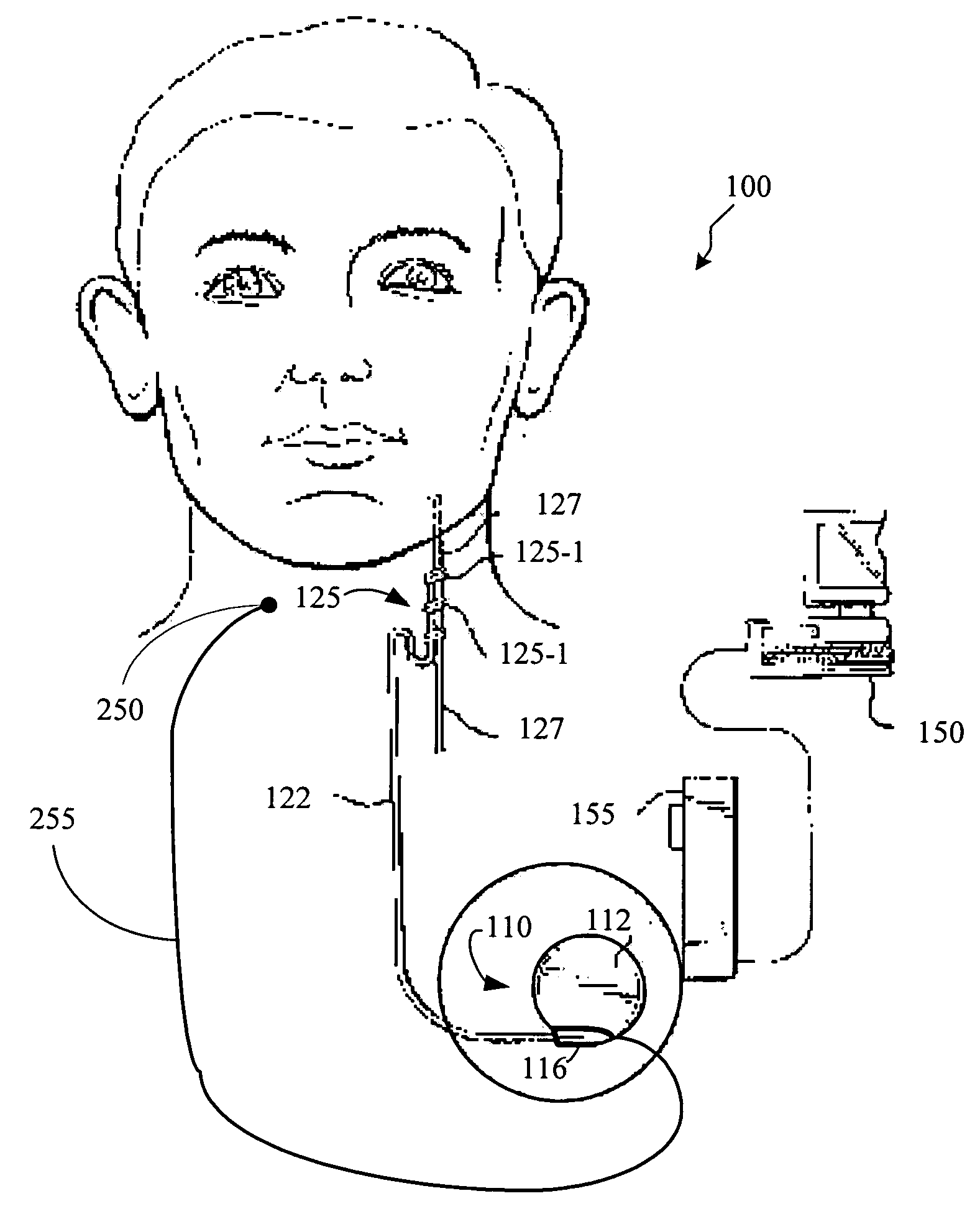 Variable output ramping for an implantable medical device