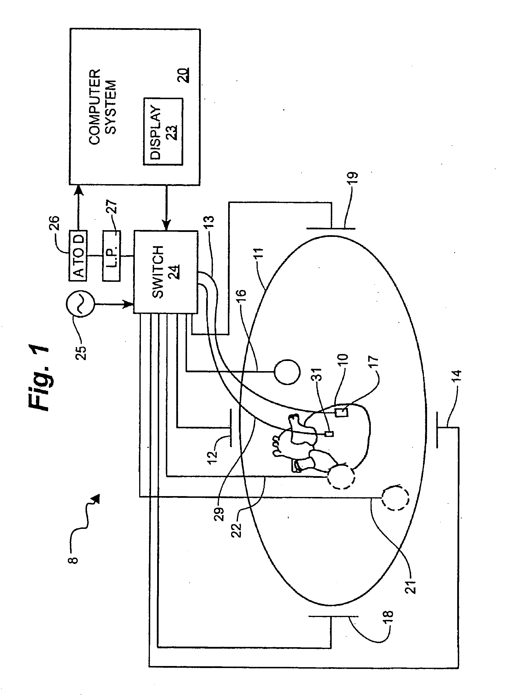 System and method for mapping complex fractionated electrogram information