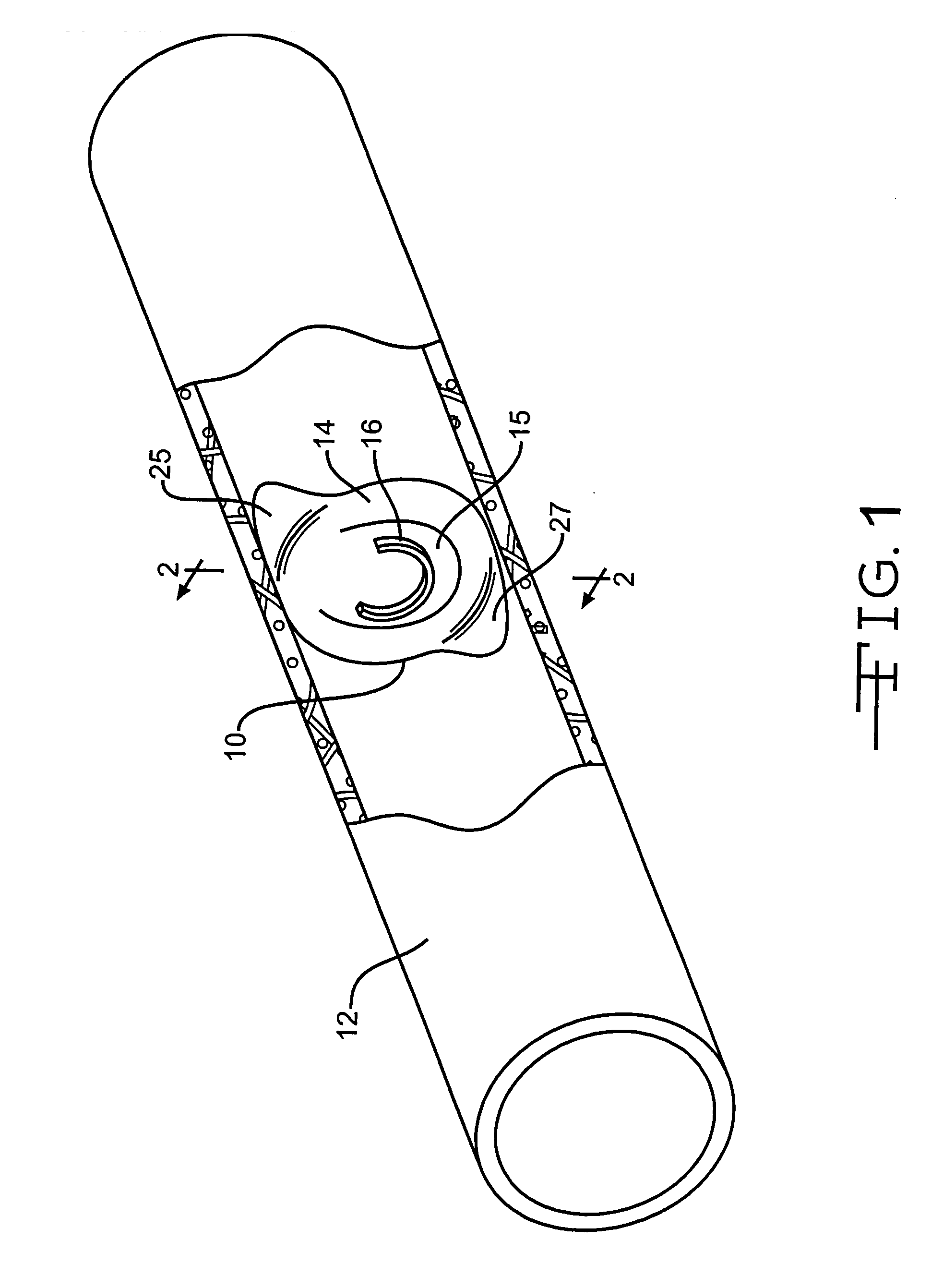 Prosthetic valve with spacing member
