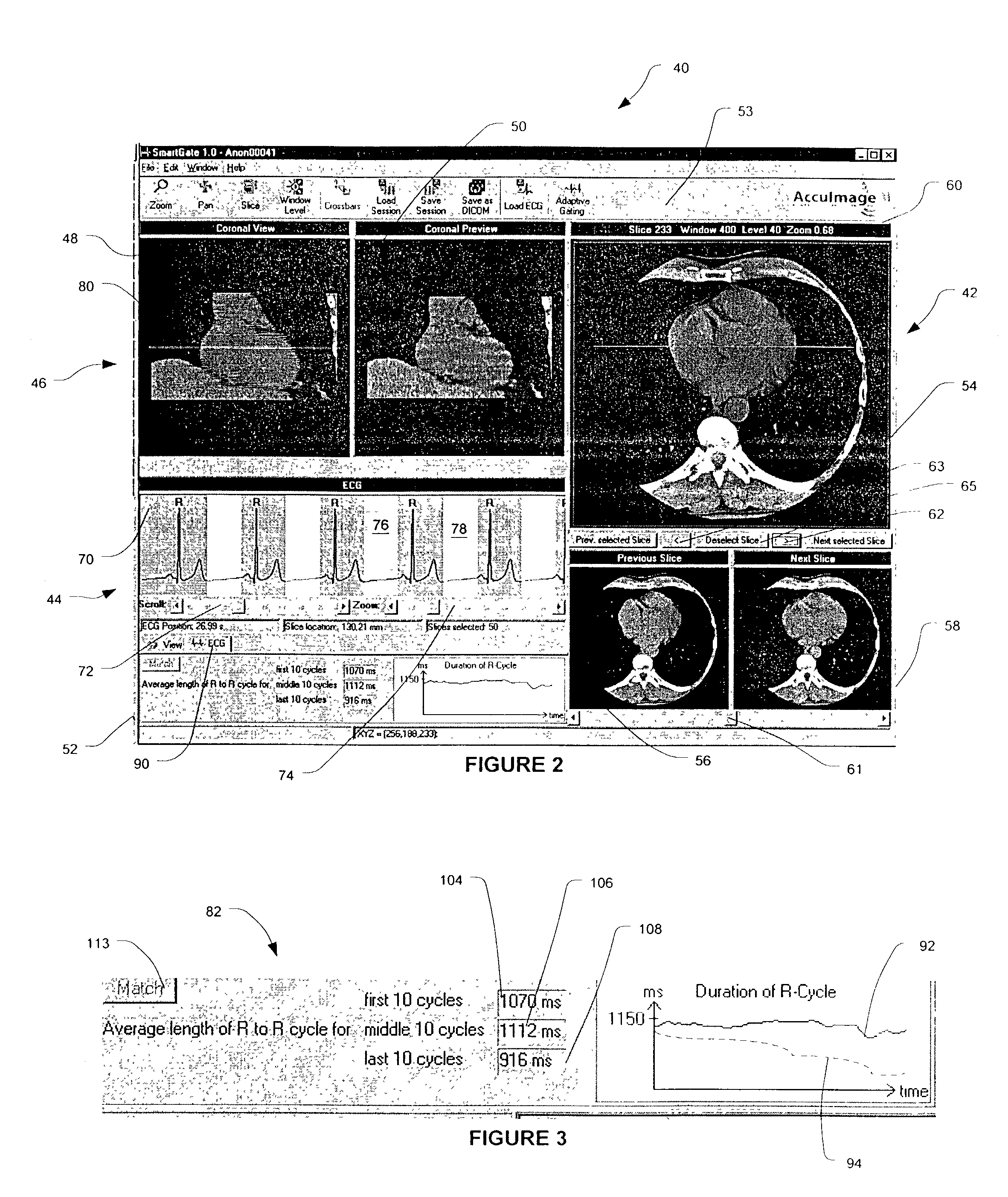 Methods and software for self-gating a set of images