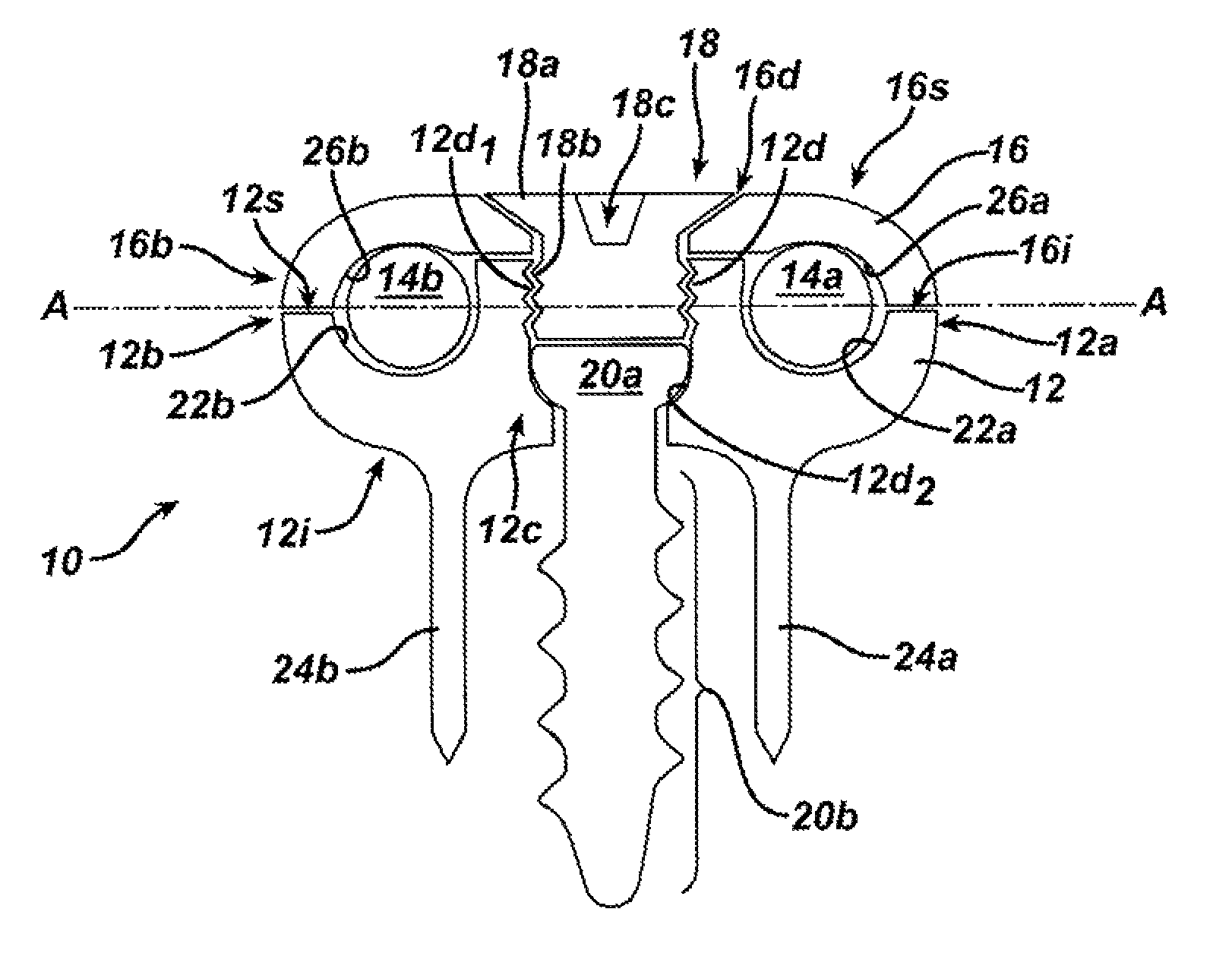 Non-fusion spinal correction systems and methods