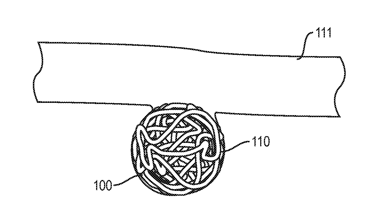 In-Situ Forming Foams for Embolizing or Occluding a Cavity