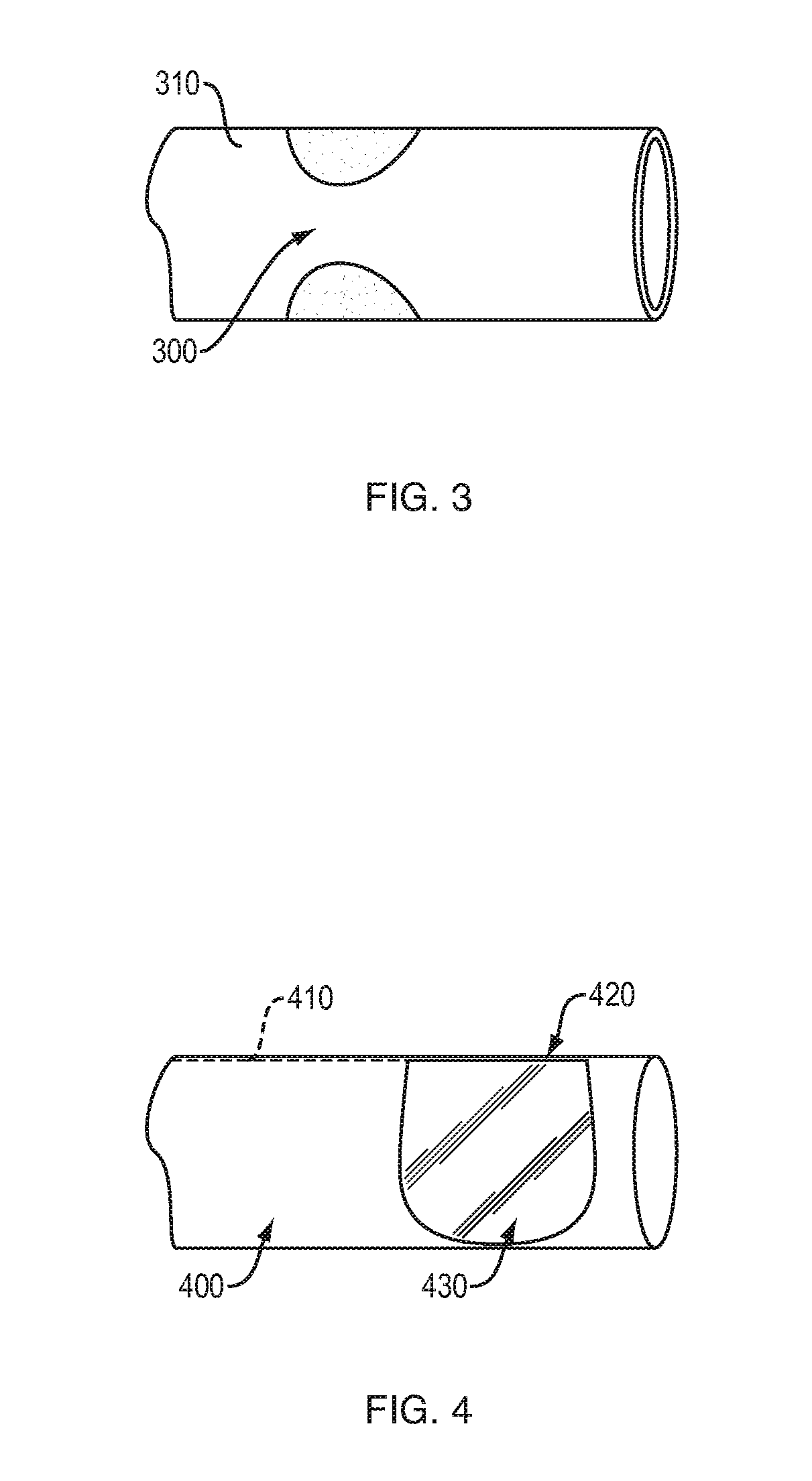 In-Situ Forming Foams for Embolizing or Occluding a Cavity