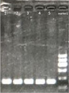 Molecular marker used for early screening cervical cancer, primer, method and kit