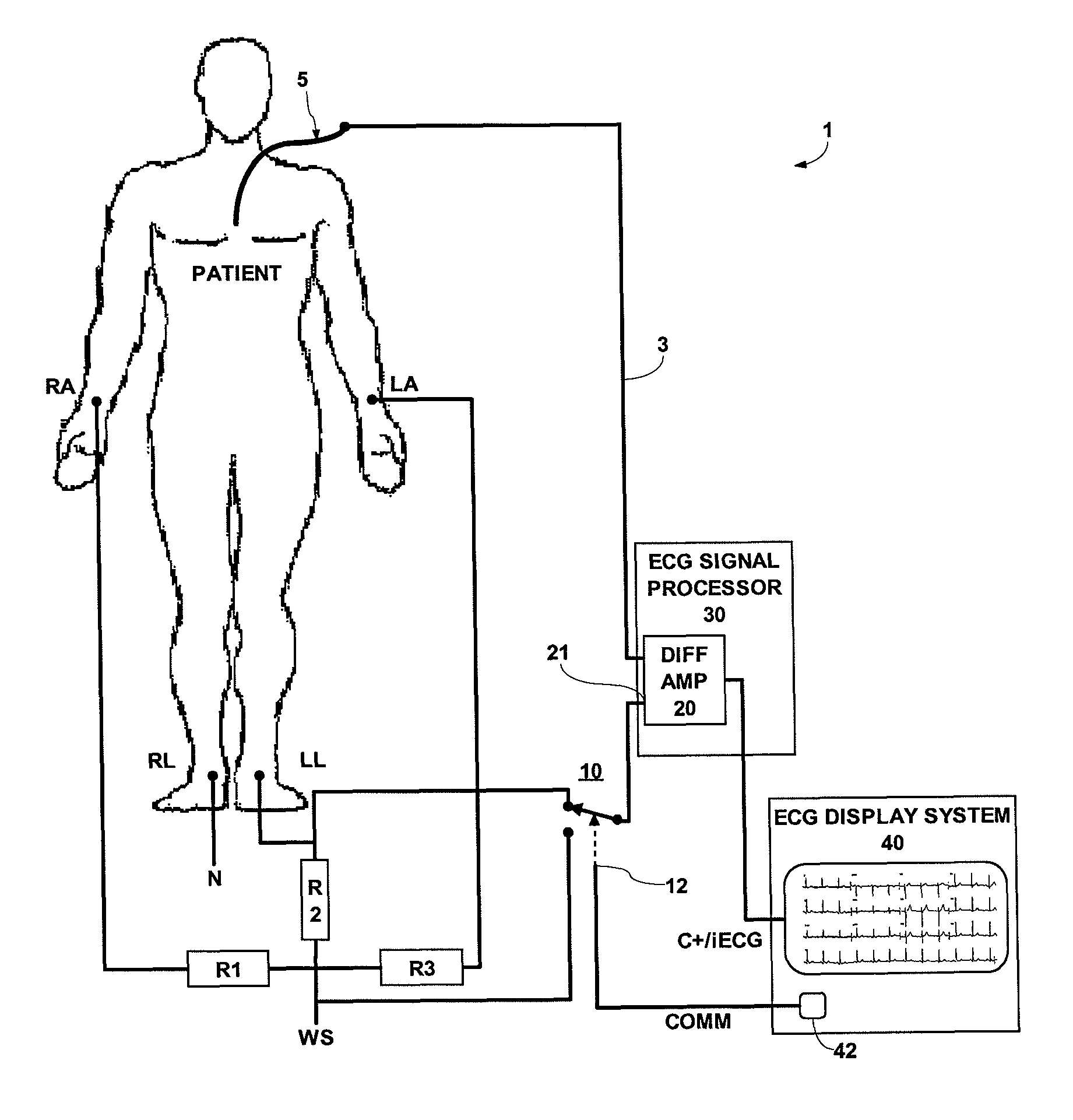 ECG system for use in ECG signal measurement of intra-cardiac ECG using a catheter