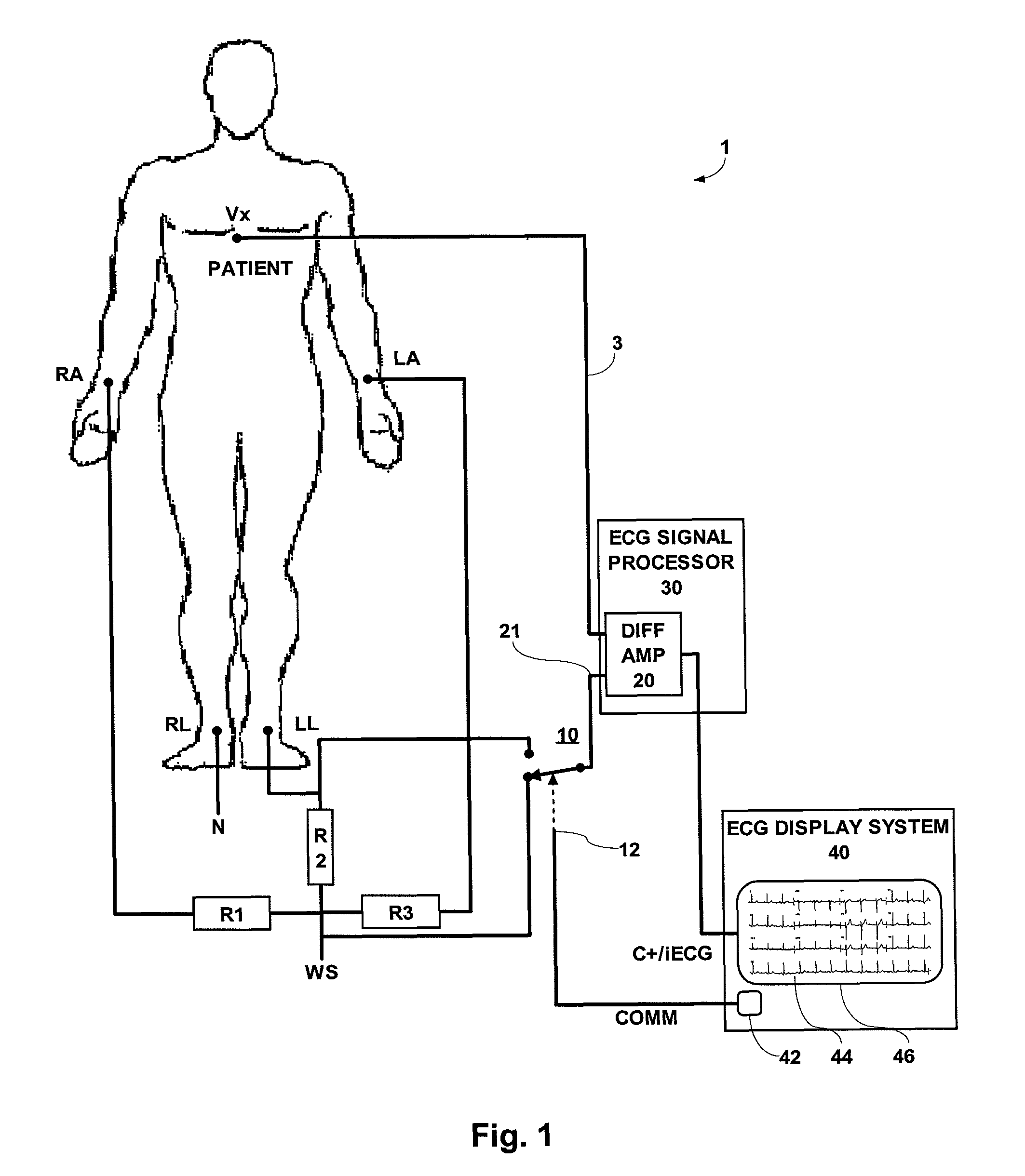 ECG system for use in ECG signal measurement of intra-cardiac ECG using a catheter