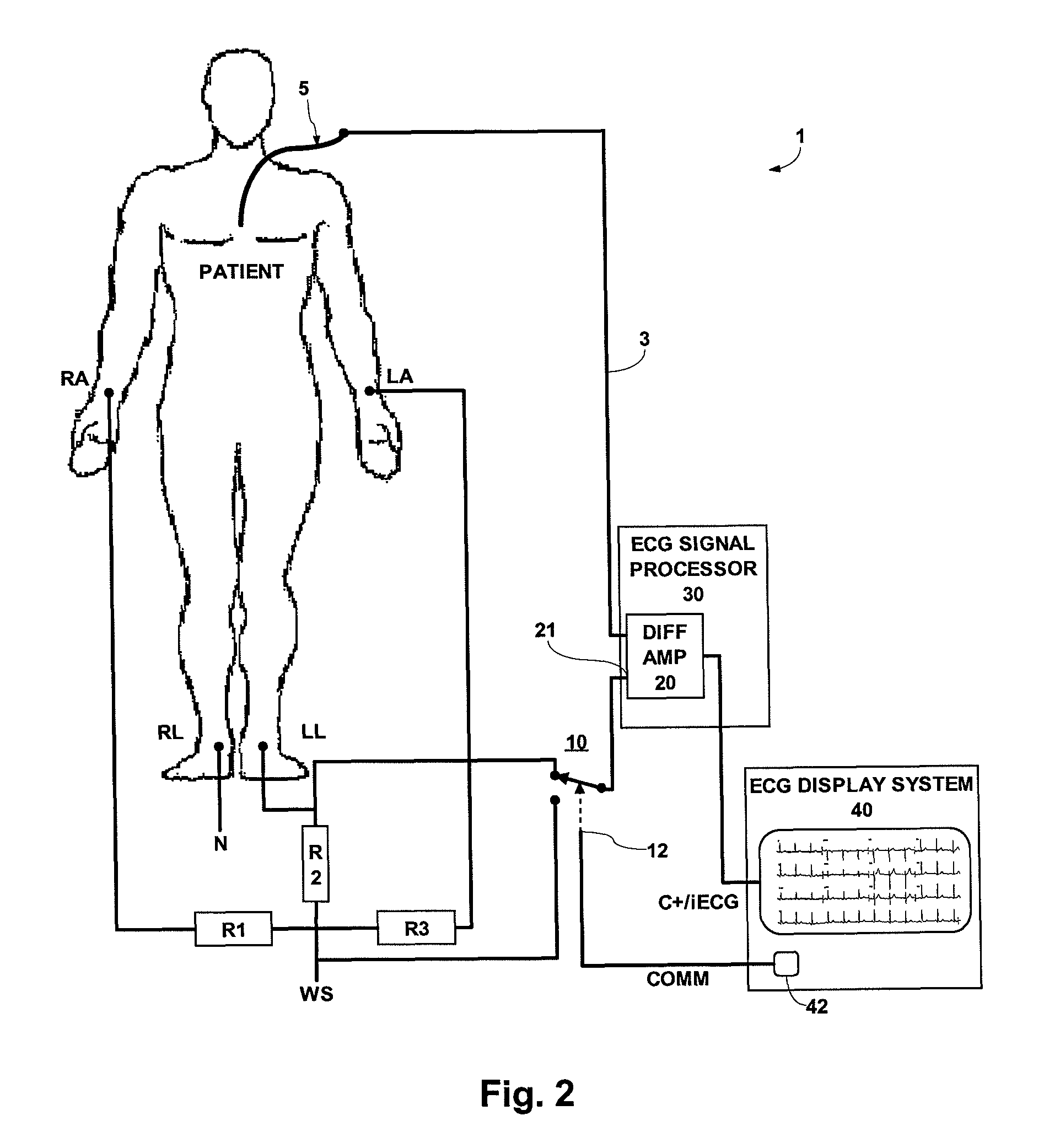 ECG system for use in ECG signal measurement of intra-cardiac ECG using a catheter