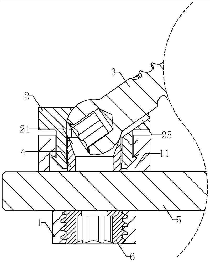 Rotatable large-angle cervical posterior cardan screw