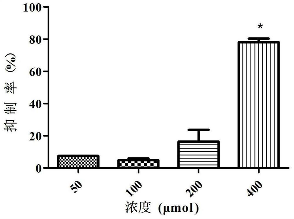 Application of a kind of teriflunomide in preparation of medicine for preventing foot-and-mouth disease virus infection