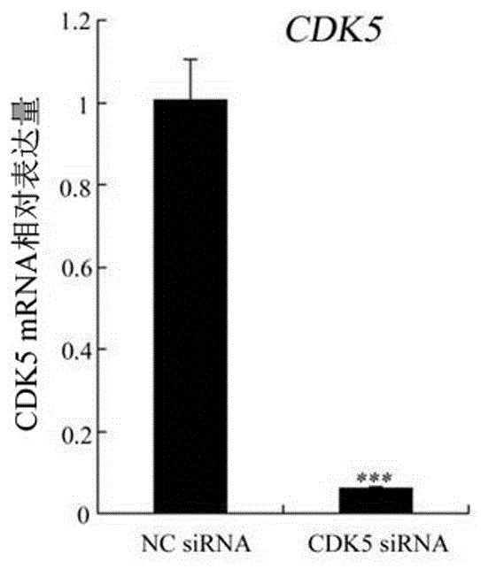 Small interfering ribonucleic acid (siRNA) capable of interfering alpaca melanin cell CDK5 gene expression, expression plasmid and application thereof