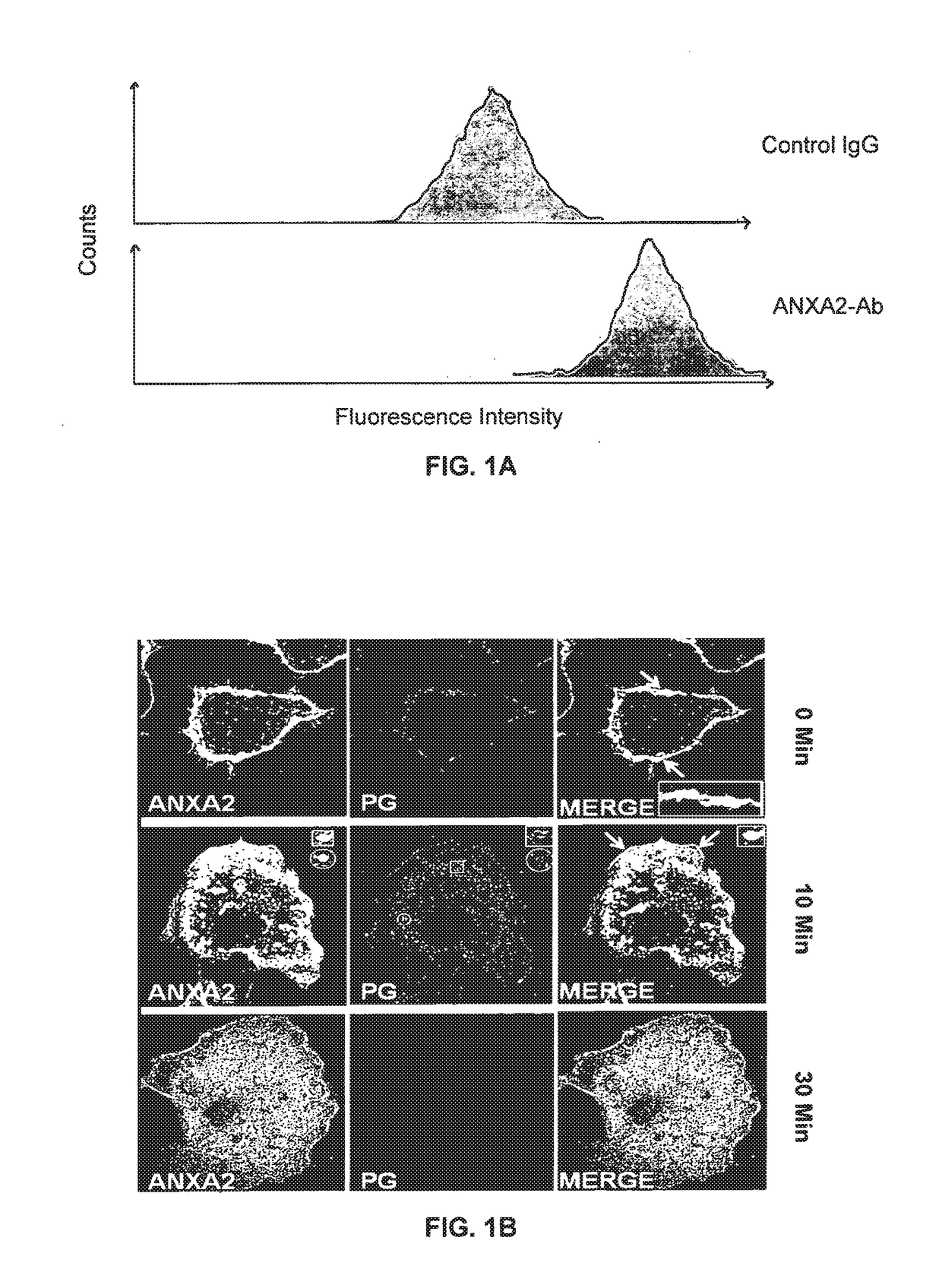 Diagnosis of benign and cancerous growths by measuring circulating tumor cells and serum annexina 2