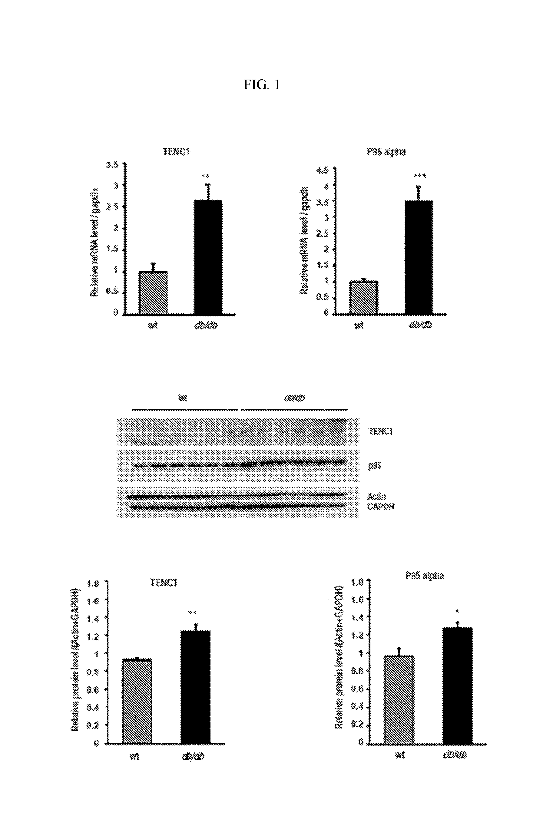 Pharmaceutical composition for preventing or treating diabetes containing TENC1 expression or activity suppressor