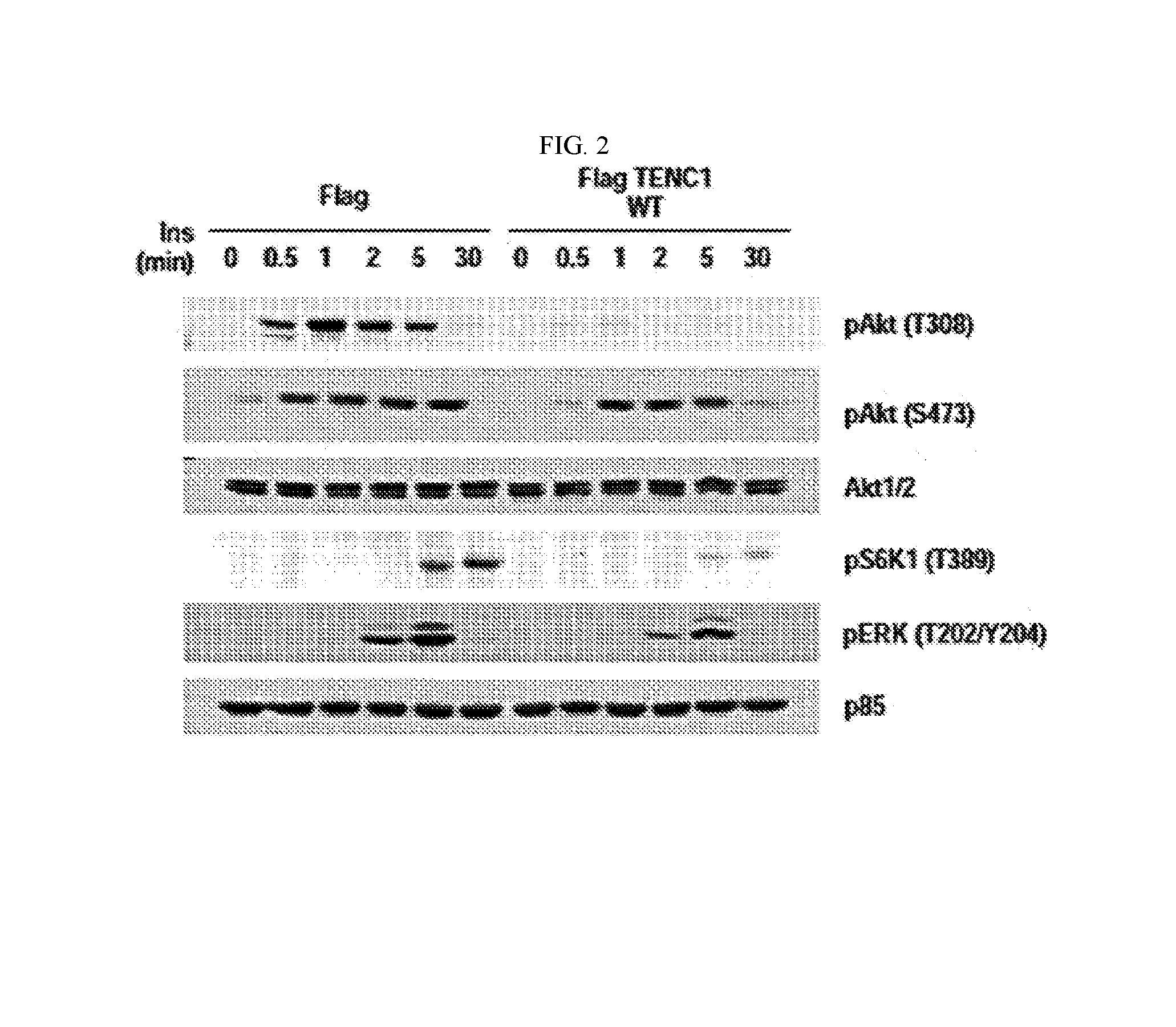 Pharmaceutical composition for preventing or treating diabetes containing TENC1 expression or activity suppressor