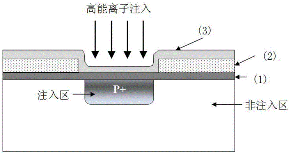 Removal method of composite mask for injecting high-energy particles