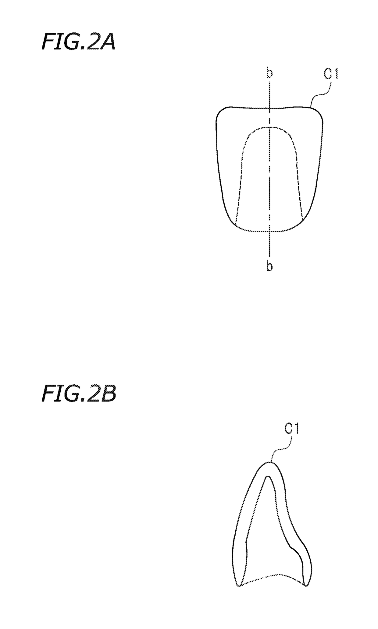 Crown prosthesis preparing system, crown prosthesis preparing method, and non-transitory storage medium storing program for preparing crown prosthesis