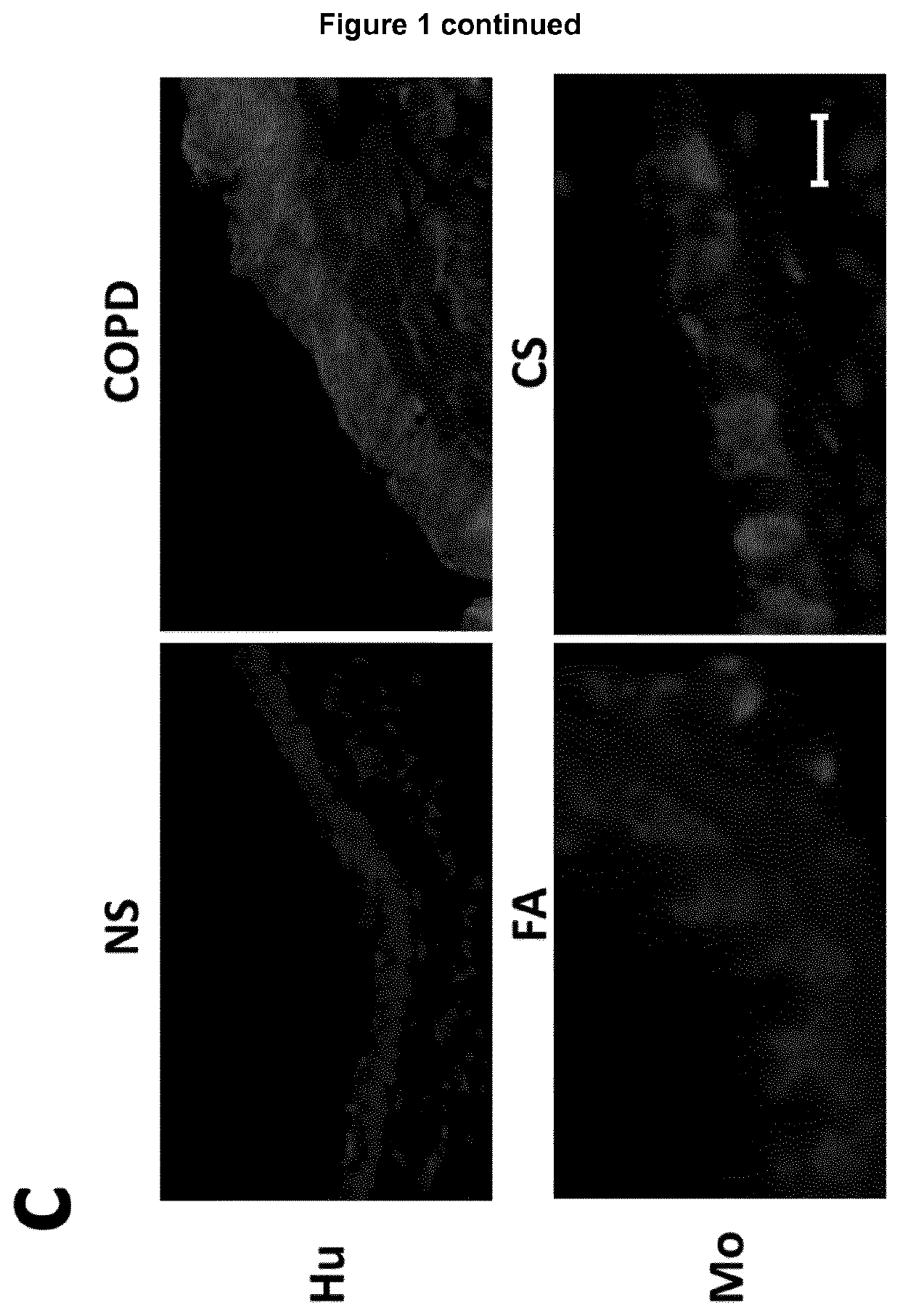 Inhibitors of cytochrome p450 family 7 subfamily b member 1 (cyp7b1) for use in treating diseases