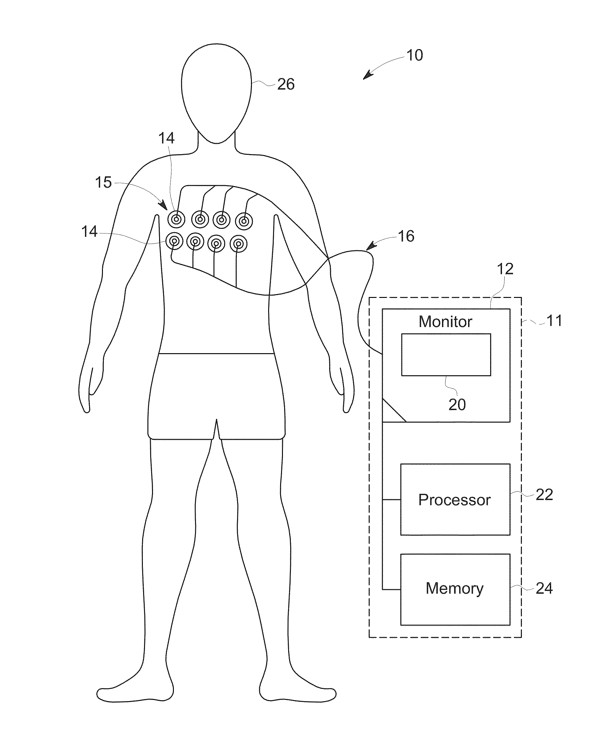 Systems and methods for soft-field tomography