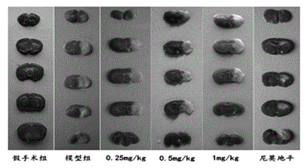 Application of cytisine in medicines for treating cerebral arterial thrombosis