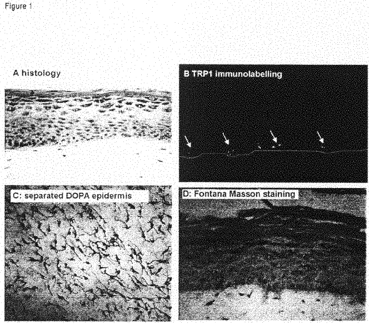 Functional pigmented skin equivalent