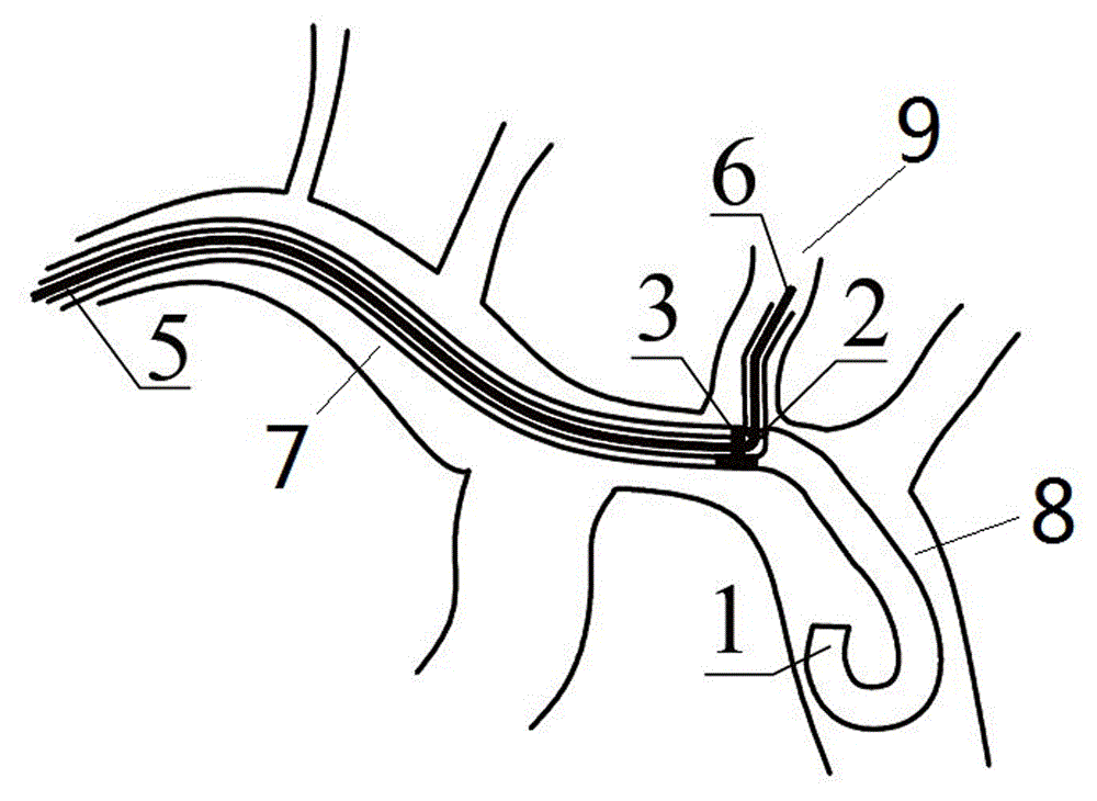 Guiding catheter and catheter assembly for angiography and angiography method