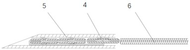 Rapid tissue suture implant and preparation method thereof