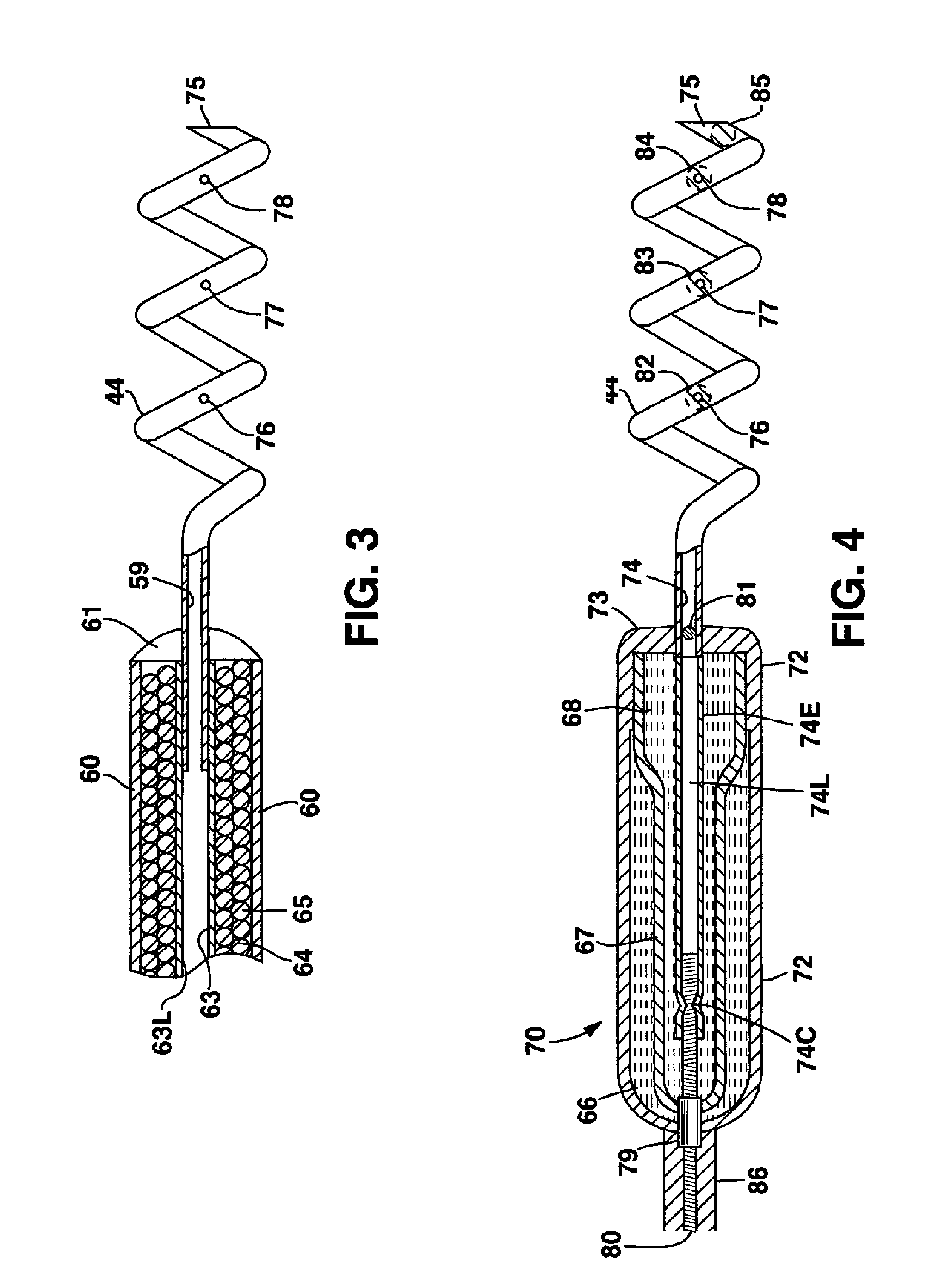 System and method for genetically treating cardiac conduction disturbances