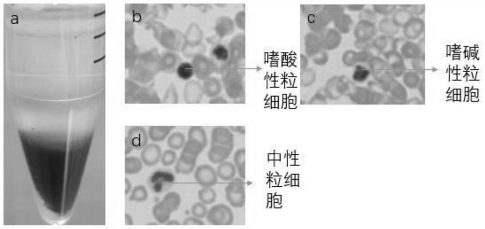 Separation method of tree shrew peripheral blood mononuclear cells