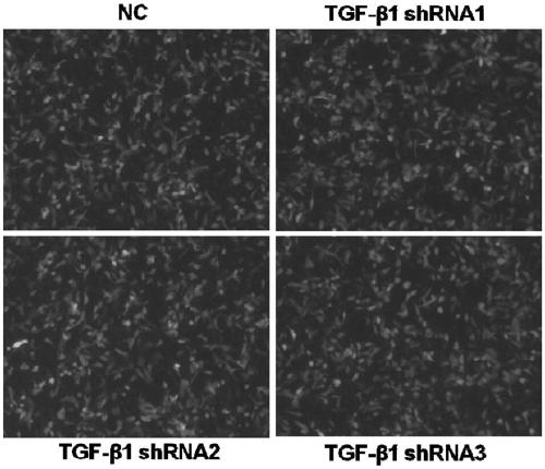shRNA and vector for knocking down TGF-beta1 (Transforming Growth Factor-beta 1), kit and application of shRNA or vector or kit