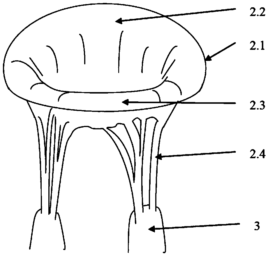 Self-adaptive locating mitral valve closing plate blocking body for repairing mitral regurgitation