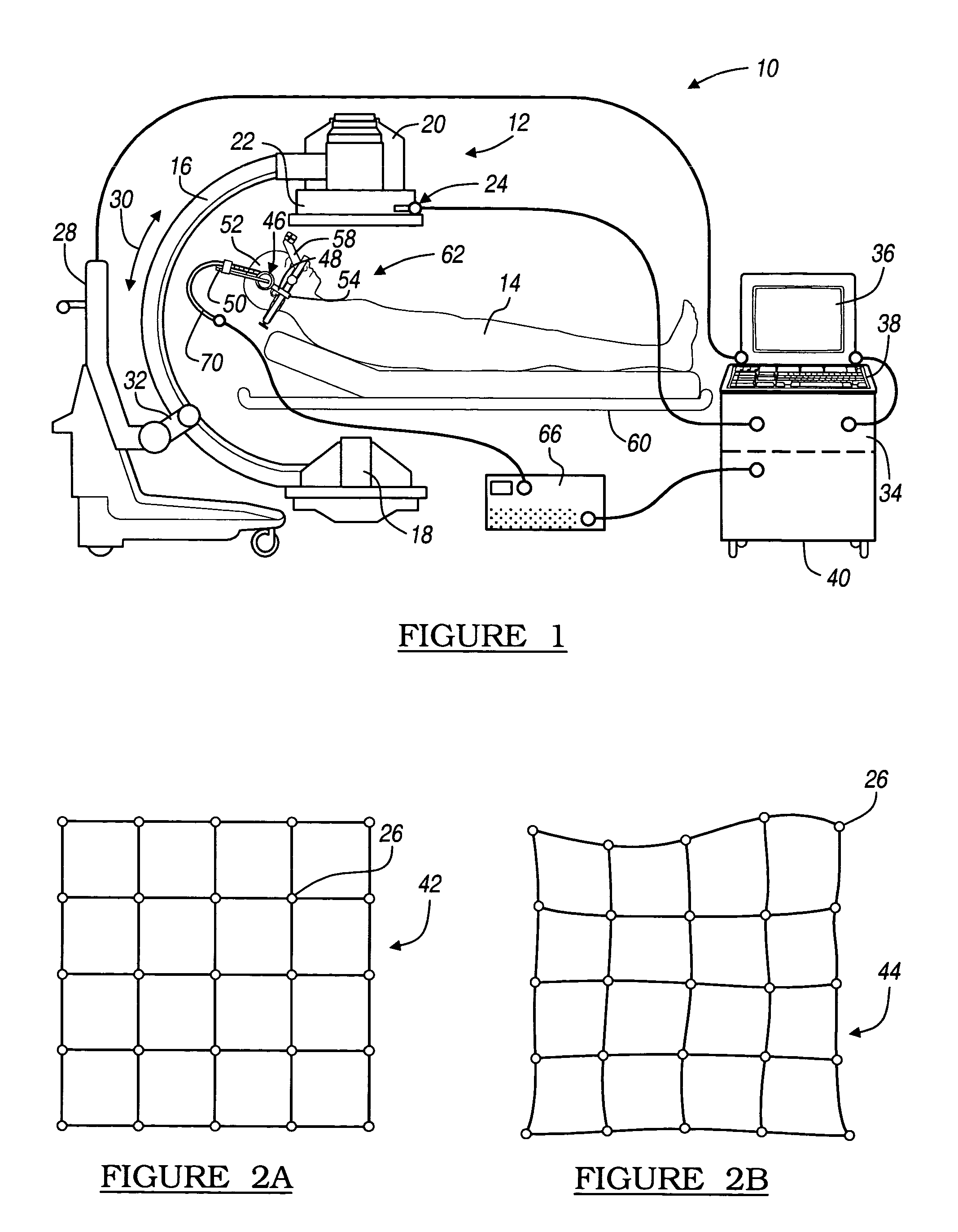 Method and apparatus for performing stereotactic surgery